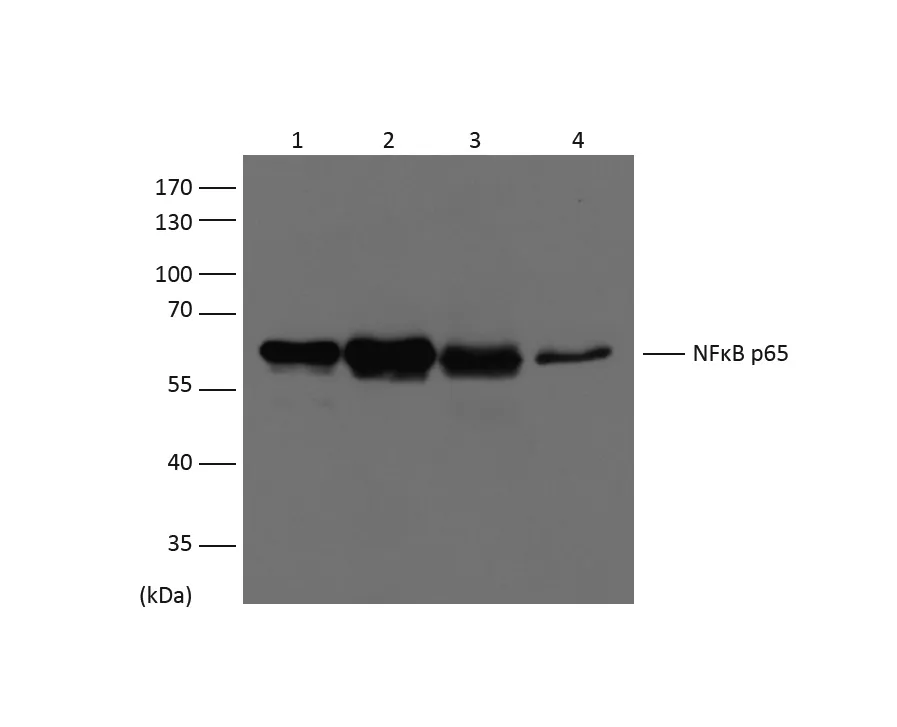 NFkB p65 Mouse mAb