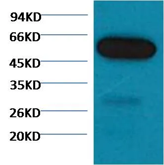 β I tubulin Mouse mAb
