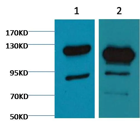 Cleaved PARP Mouse mAb