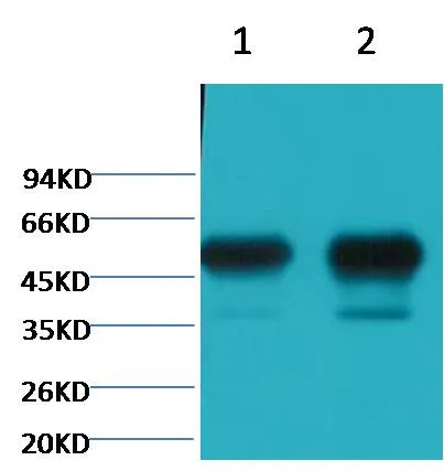 β II tubulin Mouse mAb - image 1