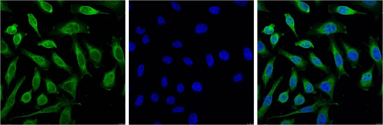 Progesterone Receptor Mouse mAb