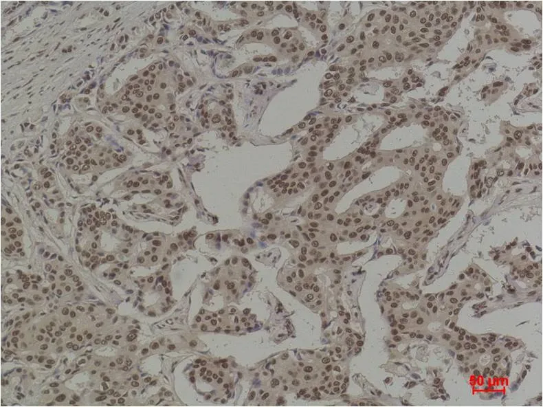 COX2/Cyclooxygenase 2 Mouse mAb - image 1