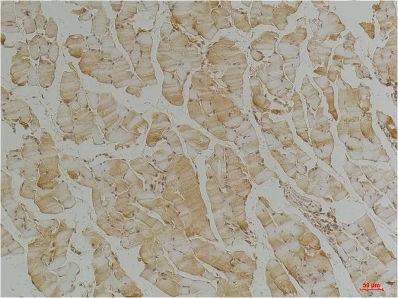 Desmin Mouse mAb