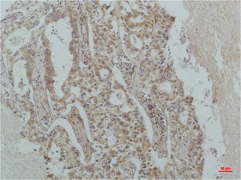 IκB β Mouse mAb