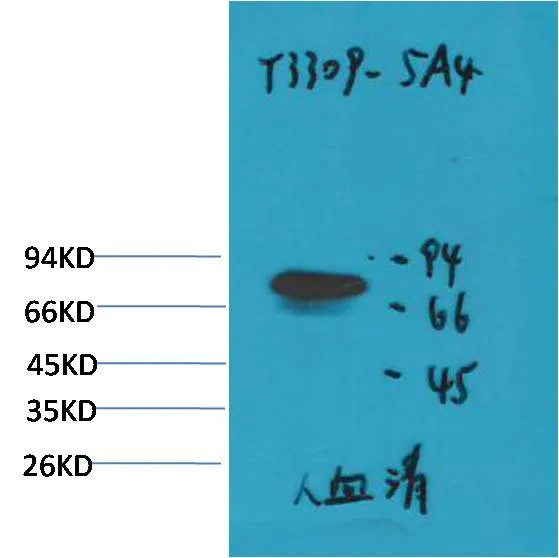 Transferrin Mouse mAb - image 1
