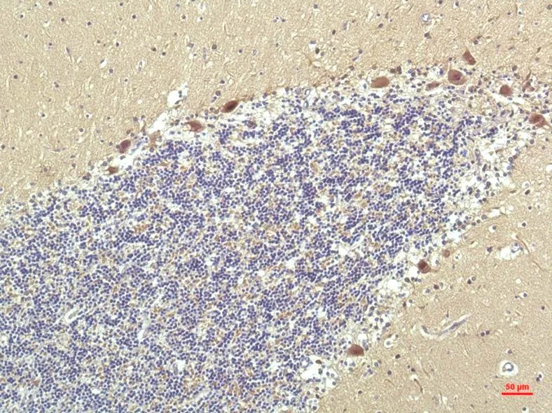 PPAR Delta (2F9) Mouse mAb - image 1