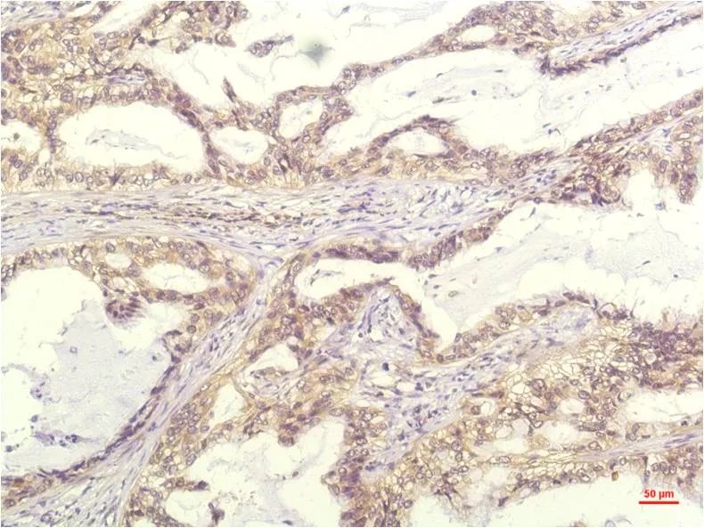 IL-8 (13F8) Mouse mAb