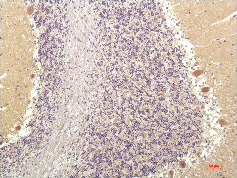 SGK1 (4D12) Mouse mAb