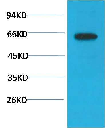 Phospho-Akt (S473) (6F8) Mouse mAb - image 1