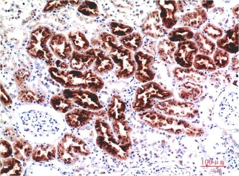 Cystatin C (7F11) Mouse mAb - image 1