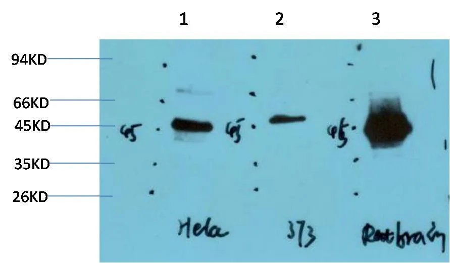 GSK3β (2C6) Mouse mAb
