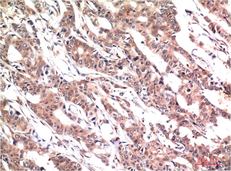 Phospho-Stat3 (Y705) (1E9) Mouse mAb - image 1
