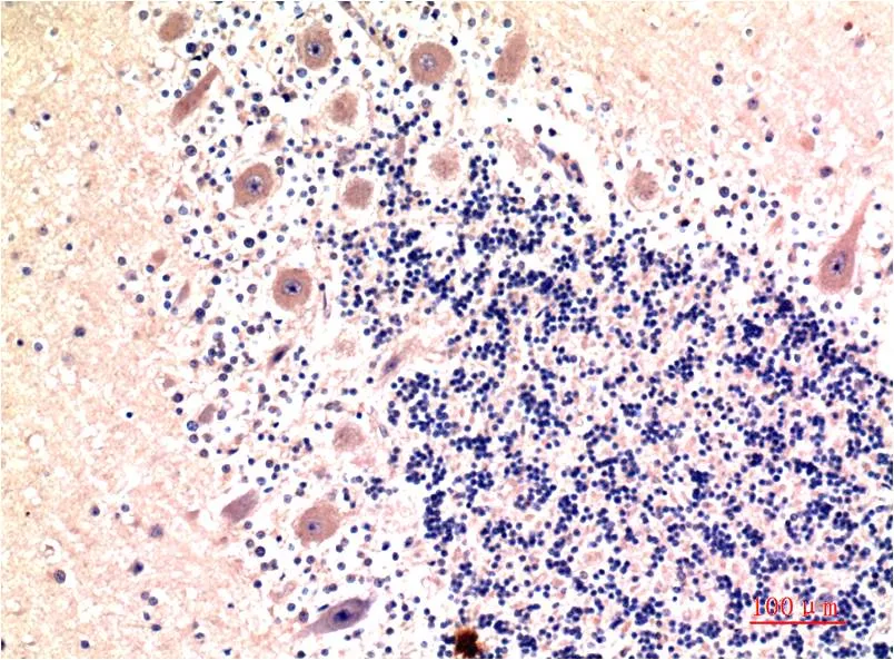 LC3B (9H5) Mouse mAb - image 1