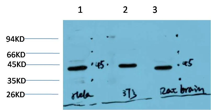 Muscle actin (3E9) Mouse mAb