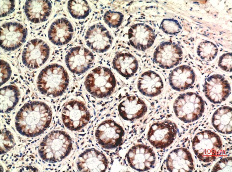 PTEN (2C10) Mouse mAb