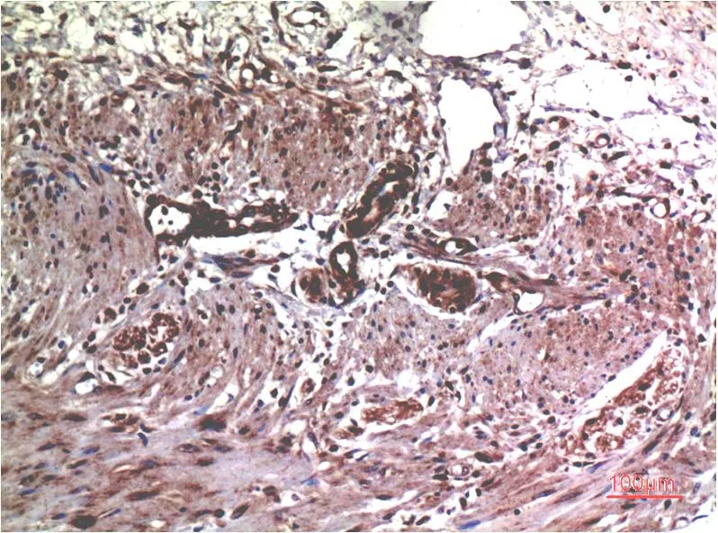 MMP2 (1H1) Mouse mAb - image 1