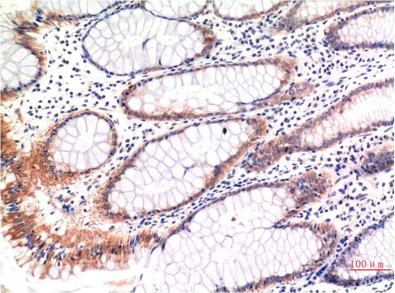 phospho-MLKL (S358) (6B4) Mouse mAb - image 1