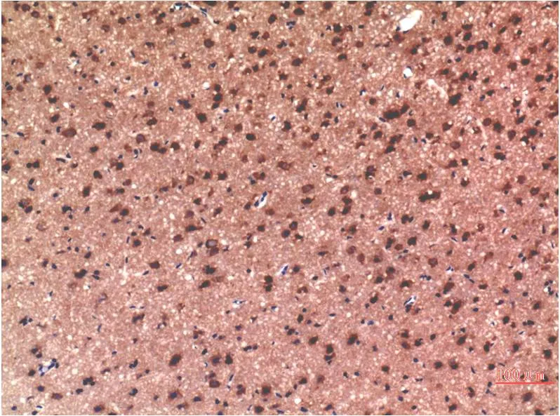 Tau (10E3) Mouse mAb