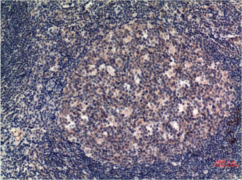MLKL (8H7) Mouse mAb - image 1