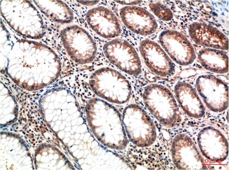 ATM (1D1) Mouse mAb