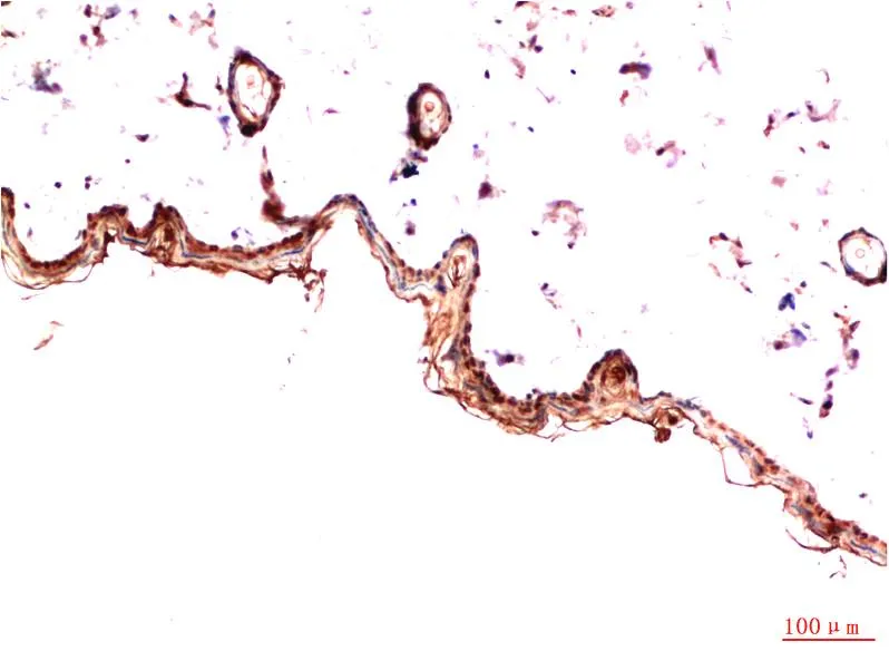 PDGFRα (5D1) Mouse mAb