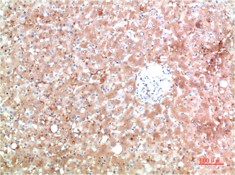 TTR (5A11) Mouse mAb