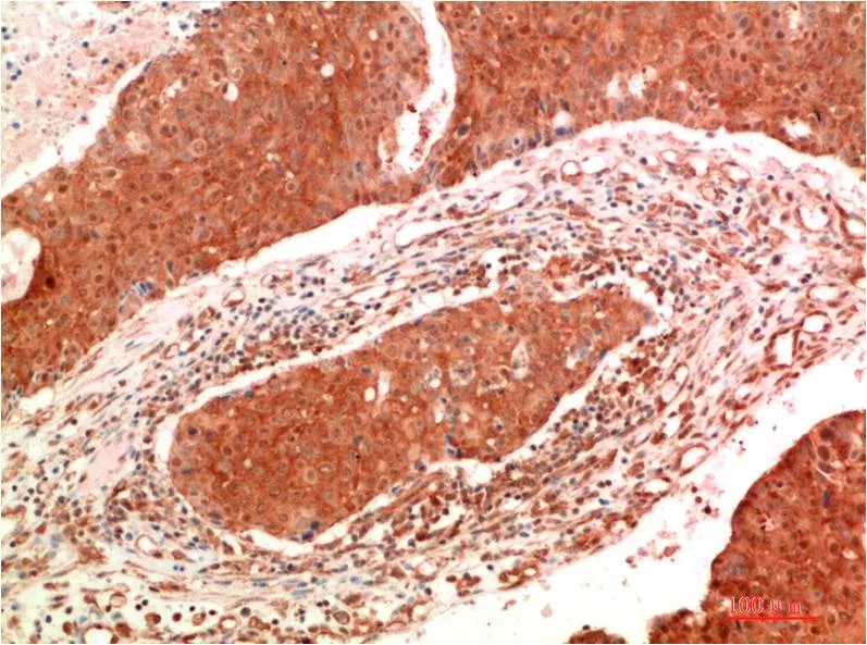 JAK2 (9B4) Mouse mAb