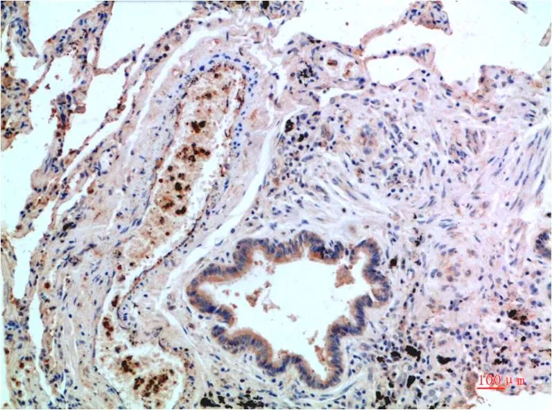 P38 (1G1) Mouse mAb