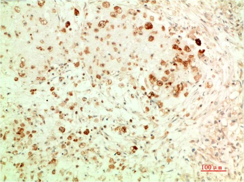 ATG5 (3C7) Mouse mAb - image 1