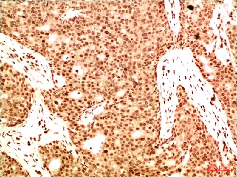 Acetyl NF kB P65 (K314/K315) (5G11) Mouse mAb