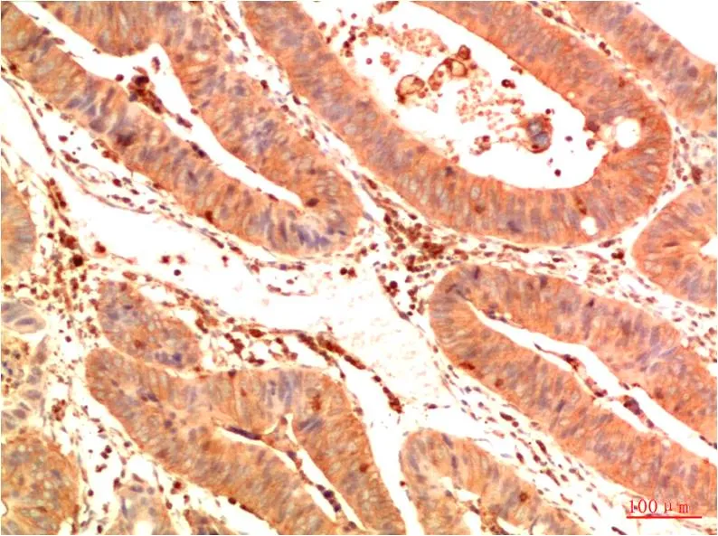 Acetyl P53 (K382) (1G7) Mouse mAb