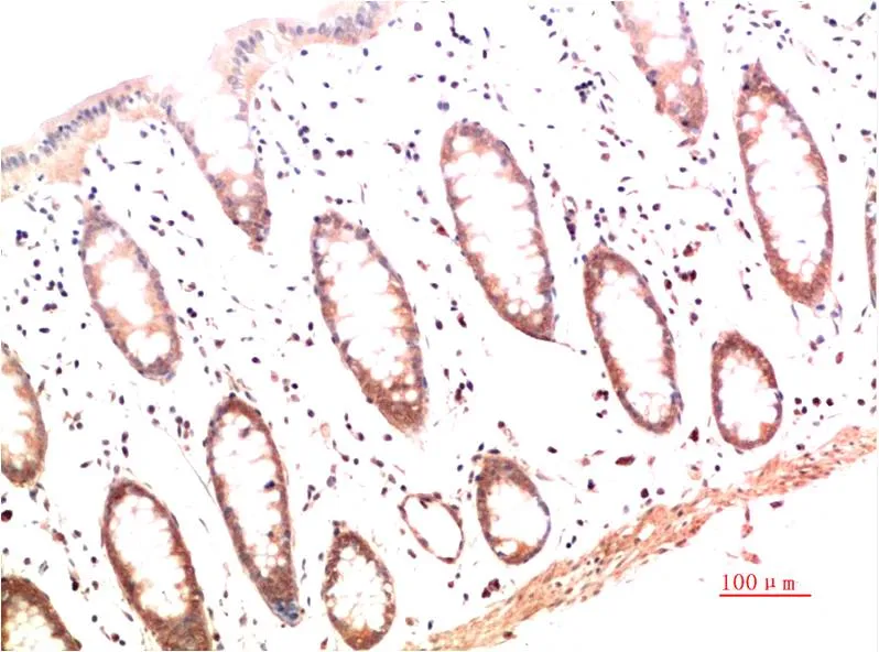 Collagen I (4B5) Mouse mAb
