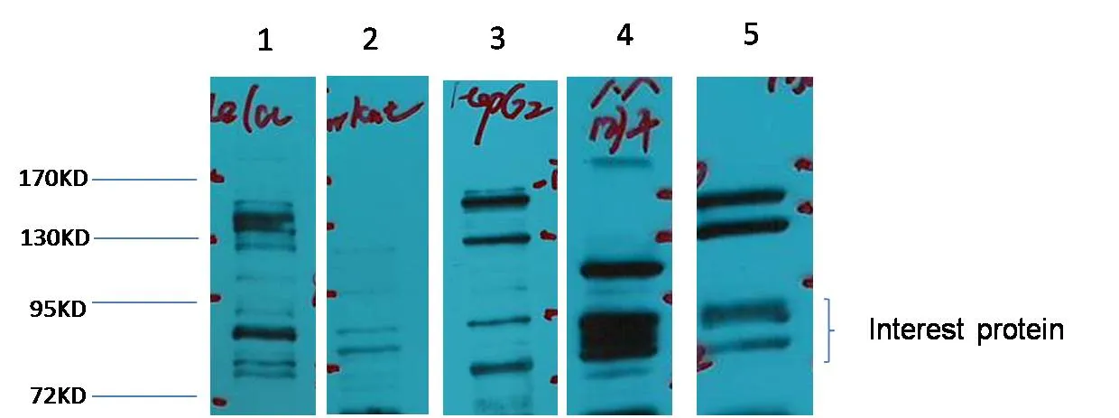 Glucocorticoid receptor Rabbit pAb - image 1