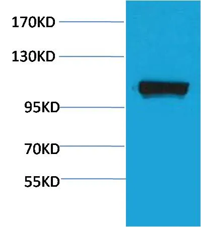 PEPC Rabbit pAb