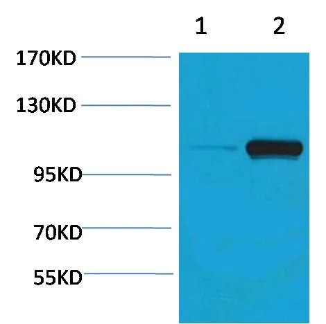 PEPC (Phospho Ser15) Rabbit pAb - image 1