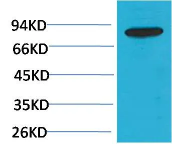 PI3 Kinase P85β Rabbit pAb - image 1