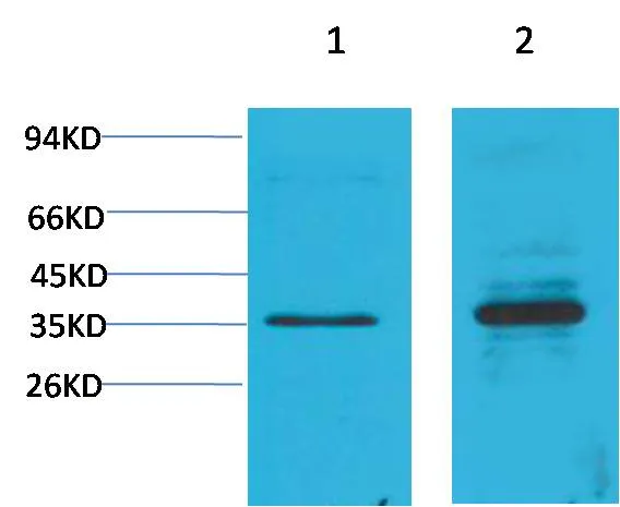 Cyclin D1 Rabbit pAb - image 1