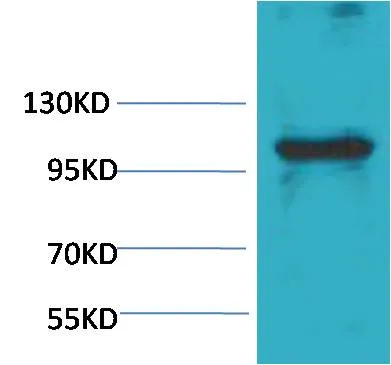 eEF1A2 binding protein Rabbit pAb - image 1
