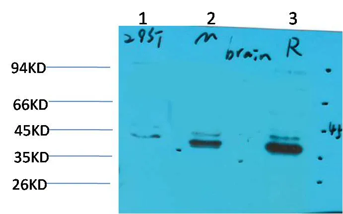CABP2 Rabbit pAb
