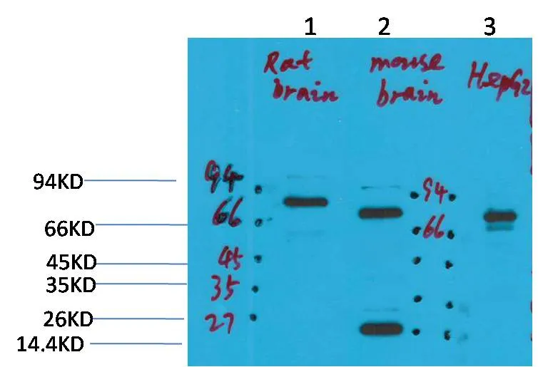 KCNN2 (SK2) Rabbit pAb - image 1