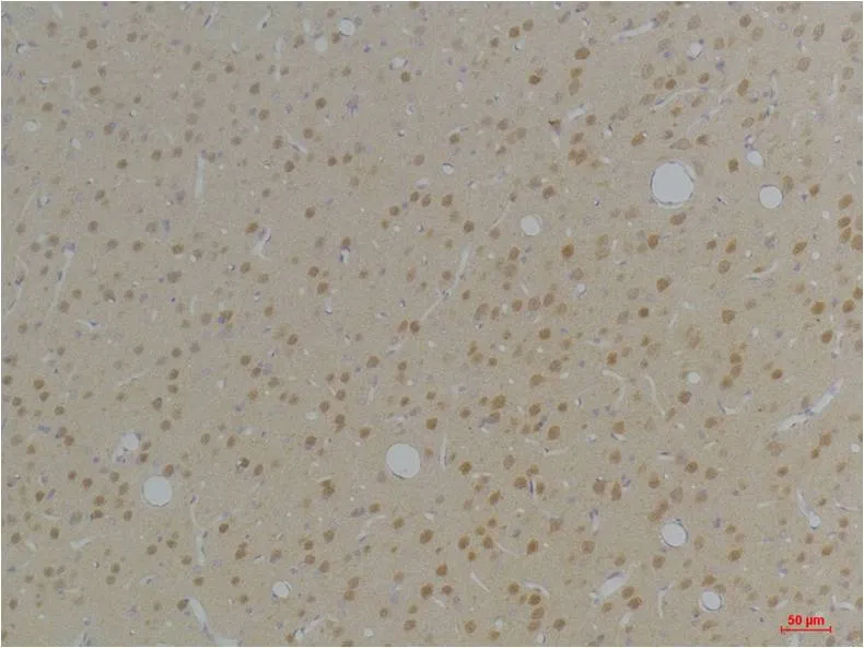 KVβ1 Rabbit pAb