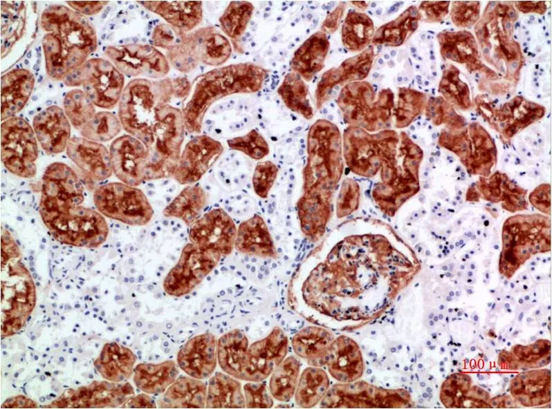 CD10 Rabbit pAb - image 1