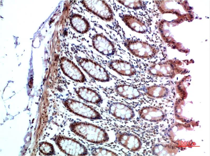 HP-1 α Rabbit pAb