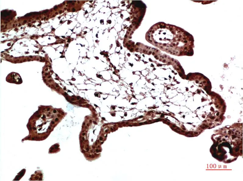 HP-1 γ Rabbit pAb - image 1