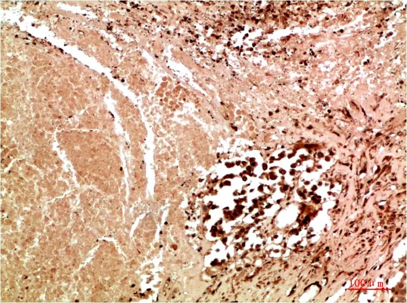 JNK3 Rabbit pAb - image 1