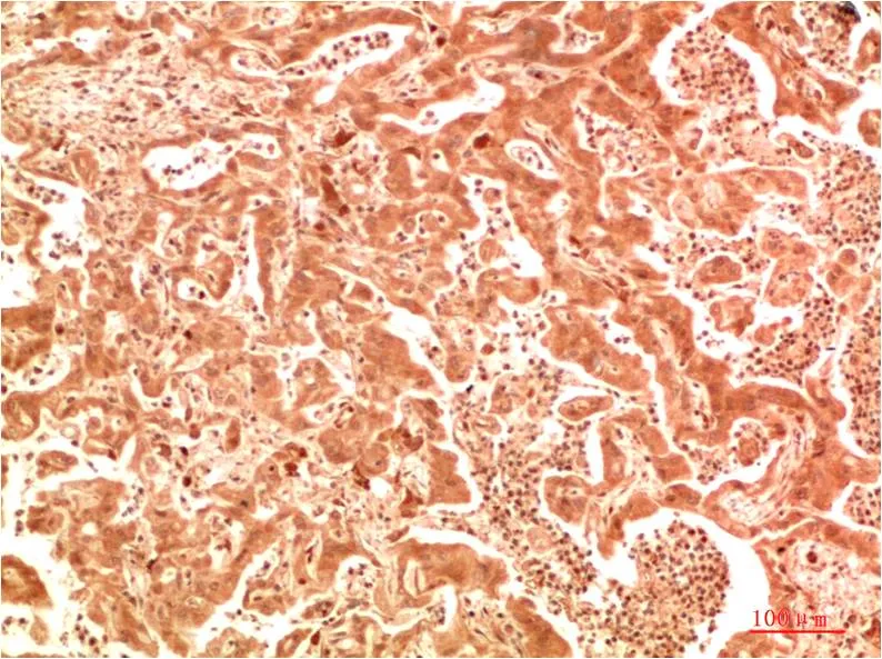 ATG7 Rabbit pAb - image 1