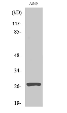 Cleaved-Cathepsin D HC (L169) rabbit pAb - image 1
