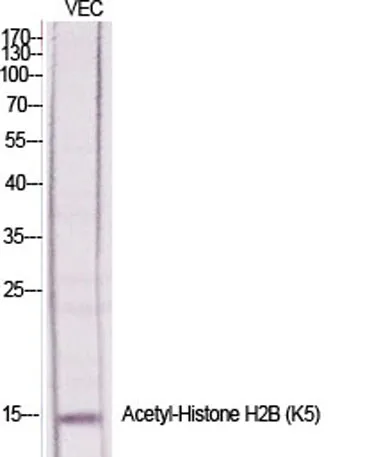 Histone H2B (Acetyl Lys5) rabbit pAb - image 1