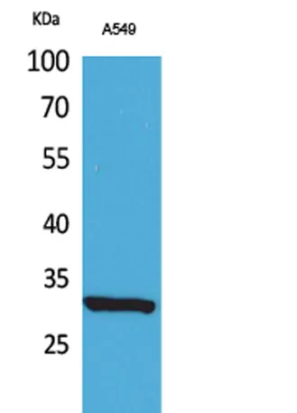 ATF-5 (Acetyl Lys29) rabbit pAb