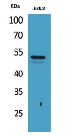 Tubulin α (Acetyl Lys40) rabbit pAb - image 1